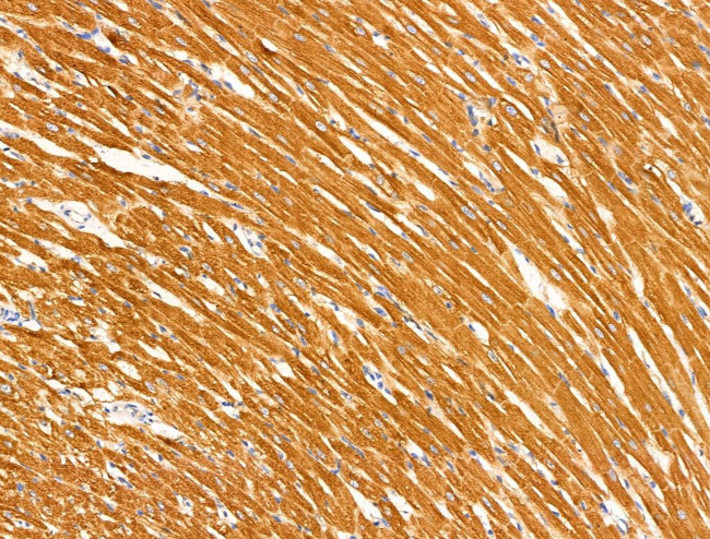 MUC13 Antibody in Immunohistochemistry (Paraffin) (IHC (P))