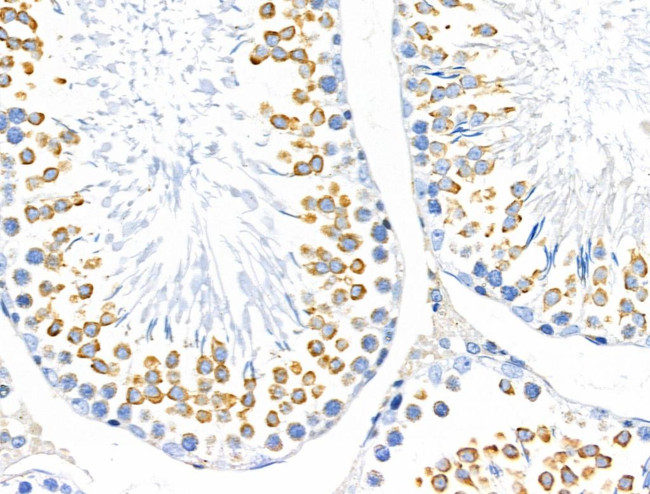 MUC13 Antibody in Immunohistochemistry (Paraffin) (IHC (P))