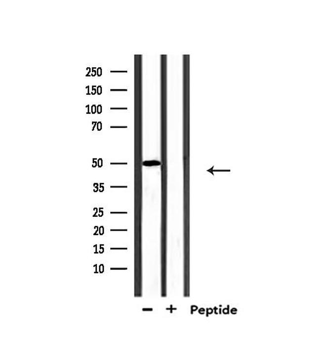 MUC13 Antibody in Western Blot (WB)