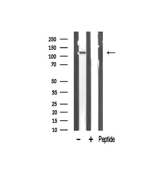 ZMYND8 Antibody in Western Blot (WB)