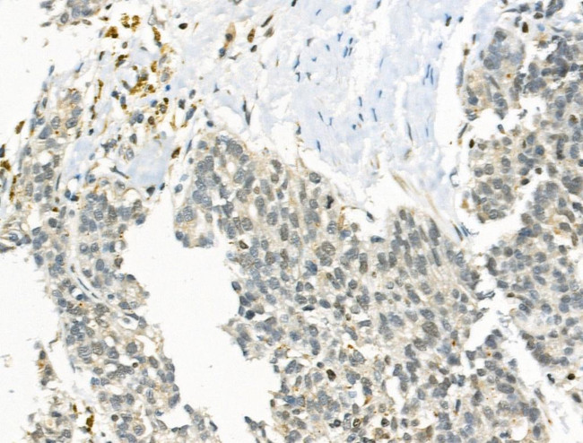 ZMYND8 Antibody in Immunohistochemistry (Paraffin) (IHC (P))