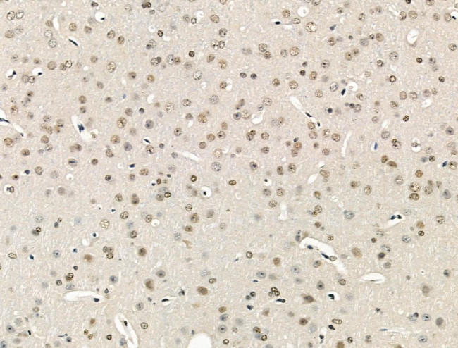 ZMYND8 Antibody in Immunohistochemistry (Paraffin) (IHC (P))