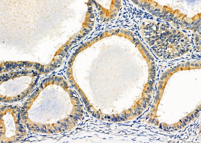 COX19 Antibody in Immunohistochemistry (Paraffin) (IHC (P))