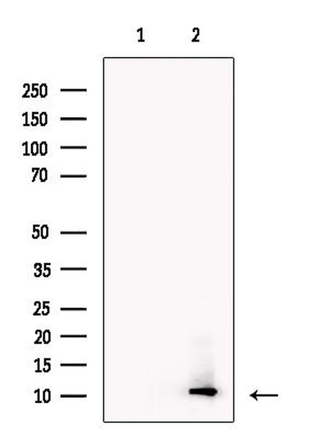 COX19 Antibody in Western Blot (WB)