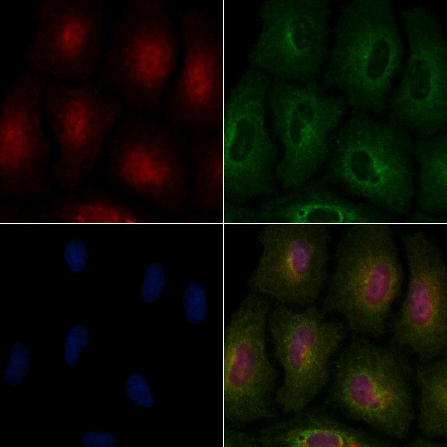 MAGE1 Antibody in Immunocytochemistry (ICC/IF)