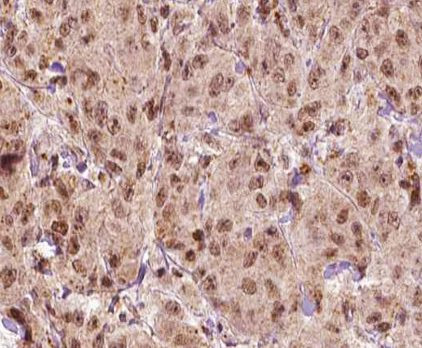 MAGE1 Antibody in Immunohistochemistry (Paraffin) (IHC (P))