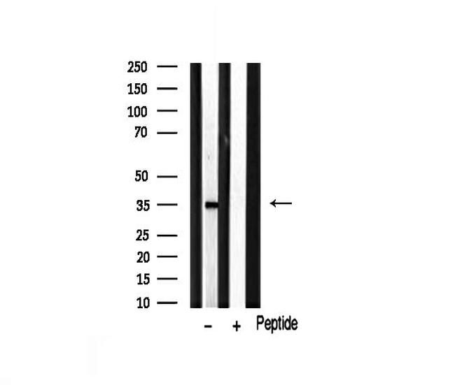 MAGE1 Antibody in Western Blot (WB)