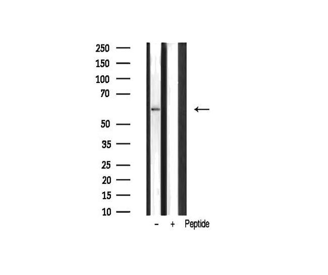 UBXD5 Antibody in Western Blot (WB)