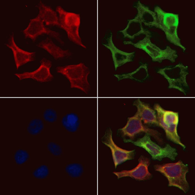 SMAD1/SMAD5/SMAD9 Antibody in Immunocytochemistry (ICC/IF)