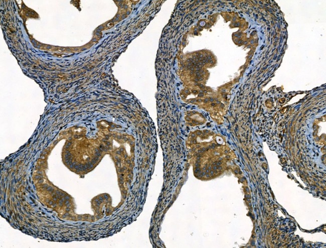 SMAD1/SMAD5/SMAD9 Antibody in Immunohistochemistry (Paraffin) (IHC (P))