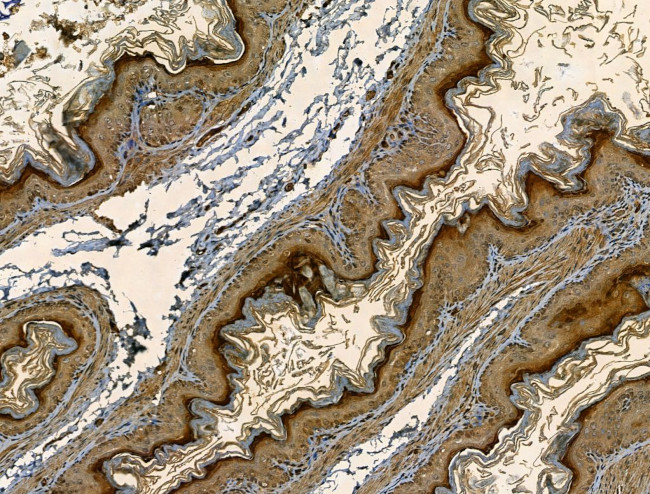 SMAD1/SMAD5/SMAD9 Antibody in Immunohistochemistry (Paraffin) (IHC (P))