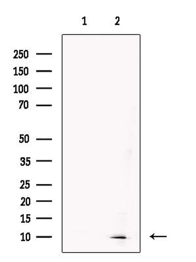 CKS2 Antibody in Western Blot (WB)