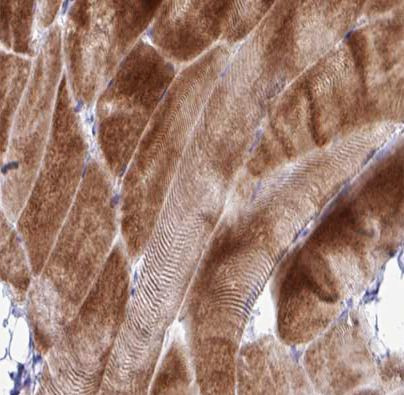 COX17 Antibody in Immunohistochemistry (Paraffin) (IHC (P))