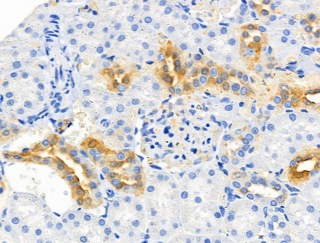 CHOP Antibody in Immunohistochemistry (Paraffin) (IHC (P))