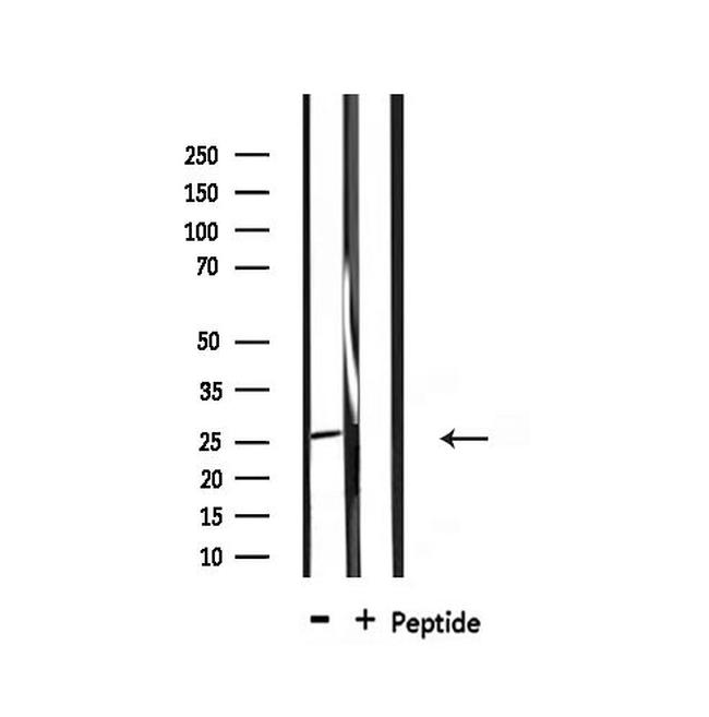 CHOP Antibody in Western Blot (WB)