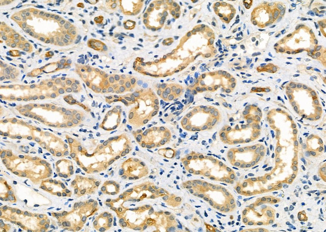 DAK Antibody in Immunohistochemistry (Paraffin) (IHC (P))