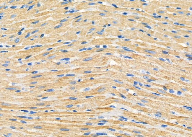 DAK Antibody in Immunohistochemistry (Paraffin) (IHC (P))