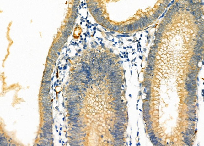 DAK Antibody in Immunohistochemistry (Paraffin) (IHC (P))