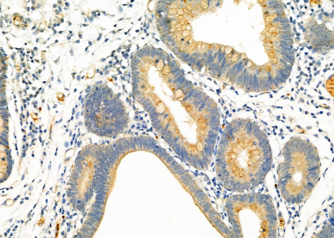 DAK Antibody in Immunohistochemistry (Paraffin) (IHC (P))