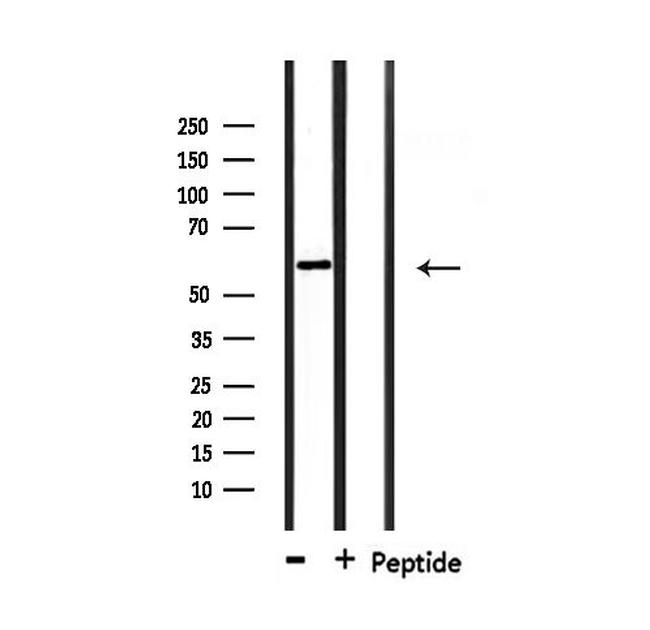 DAK Antibody in Western Blot (WB)