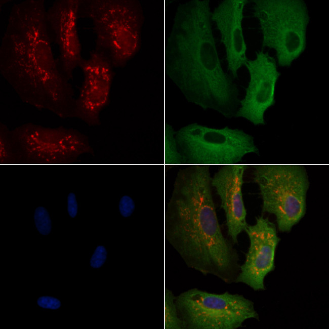 COX4I2 Antibody in Immunocytochemistry (ICC/IF)