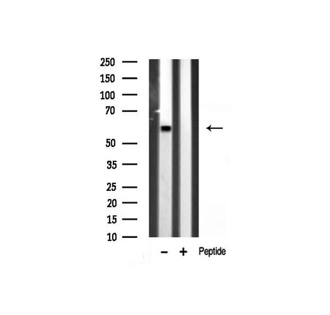 GAD65/GAD67 Antibody in Western Blot (WB)