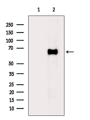 GAD65/GAD67 Antibody in Western Blot (WB)