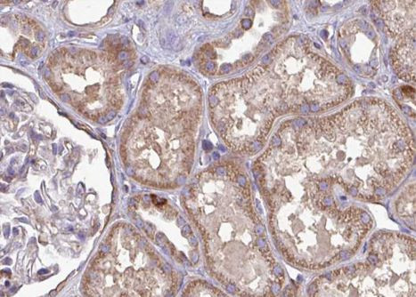 BATF Antibody in Immunohistochemistry (Paraffin) (IHC (P))