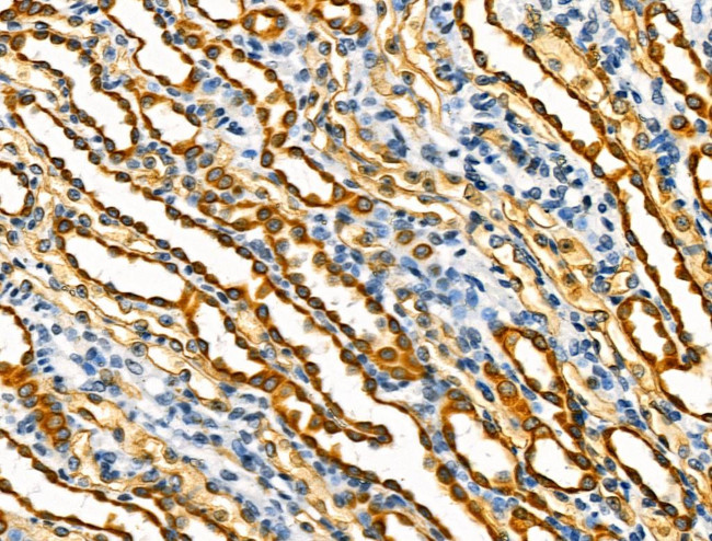 BATF Antibody in Immunohistochemistry (Paraffin) (IHC (P))