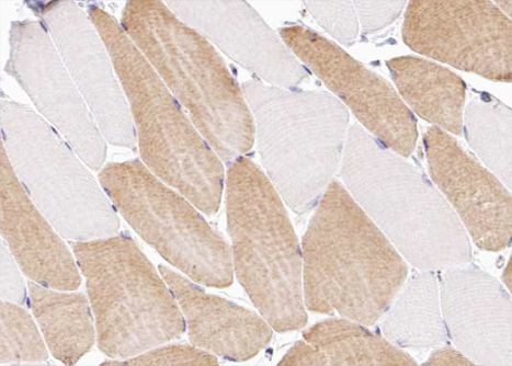 COL12A1 Antibody in Immunohistochemistry (Paraffin) (IHC (P))