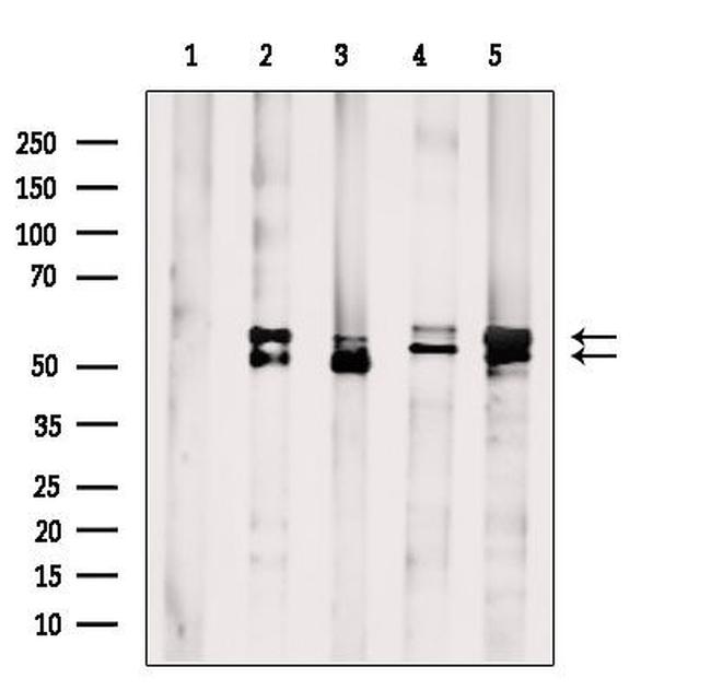 AKT Pan Antibody in Western Blot (WB)