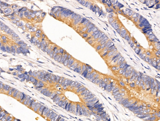 AKT Pan Antibody in Immunohistochemistry (Paraffin) (IHC (P))