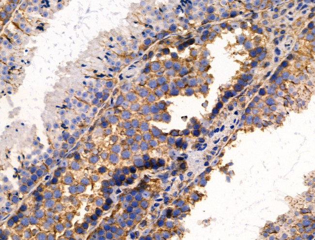 AKT Pan Antibody in Immunohistochemistry (Paraffin) (IHC (P))