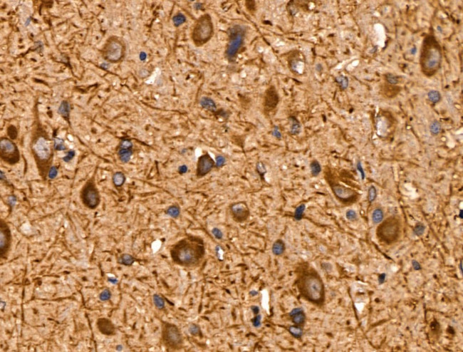 AKT Pan Antibody in Immunohistochemistry (Paraffin) (IHC (P))