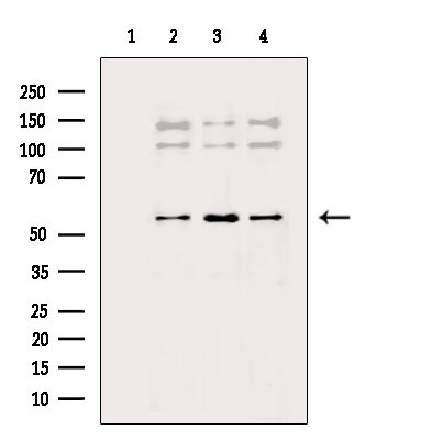 AKT Pan Antibody in Western Blot (WB)