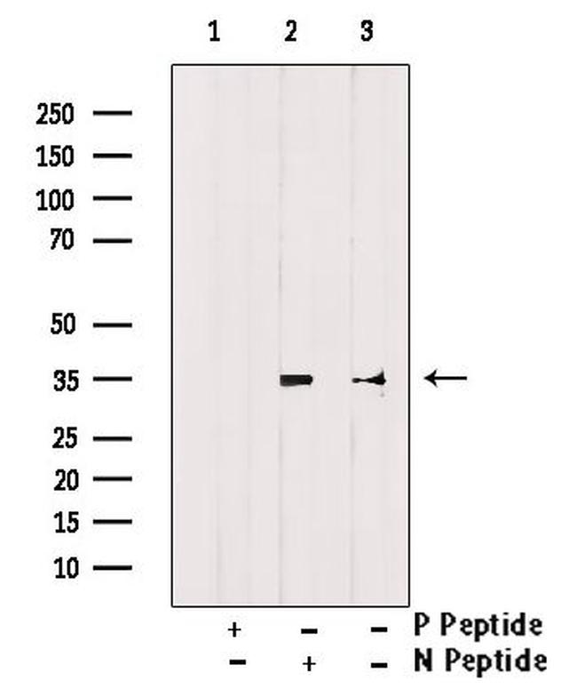 Phospho-Cyclin D1 (Thr286) Antibody in Western Blot (WB)