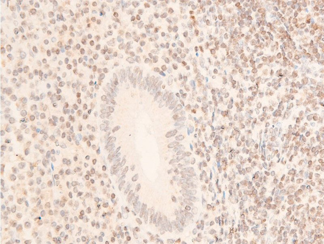 Phospho-JAK1 (Tyr1034) Antibody in Immunohistochemistry (Paraffin) (IHC (P))