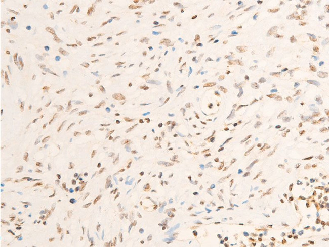 Phospho-JAK1 (Tyr1034) Antibody in Immunohistochemistry (Paraffin) (IHC (P))