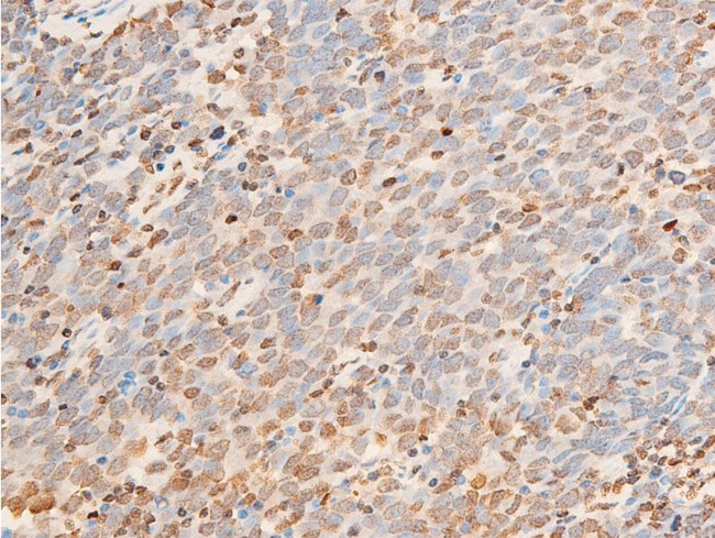 Phospho-JAK1 (Tyr1034) Antibody in Immunohistochemistry (Paraffin) (IHC (P))