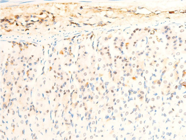 Phospho-JAK1 (Tyr1034) Antibody in Immunohistochemistry (Paraffin) (IHC (P))