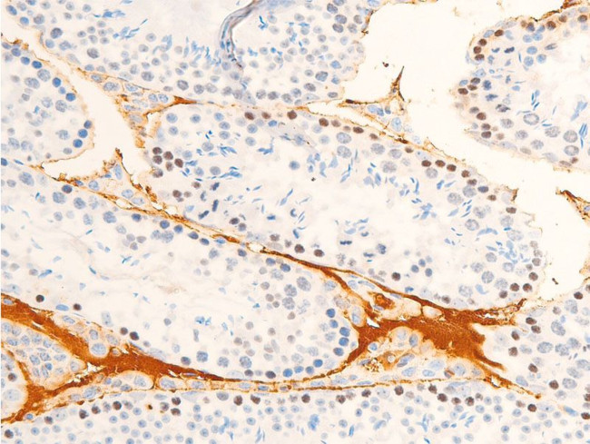 Phospho-JAK1 (Tyr1034) Antibody in Immunohistochemistry (Paraffin) (IHC (P))