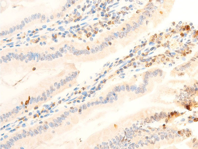 Phospho-JAK1 (Tyr1034) Antibody in Immunohistochemistry (Paraffin) (IHC (P))