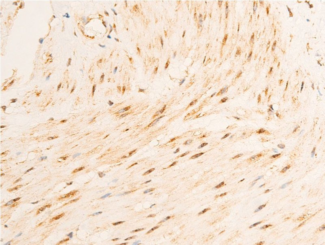 Phospho-GSK3B (Ser9) Antibody in Immunohistochemistry (Paraffin) (IHC (P))