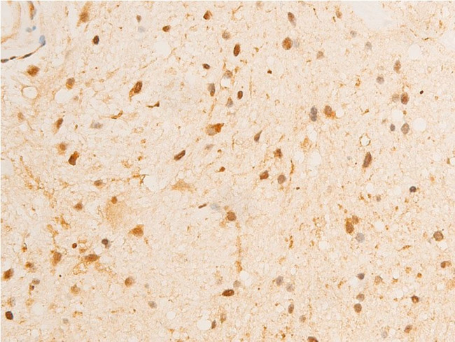 Phospho-GSK3B (Ser9) Antibody in Immunohistochemistry (Paraffin) (IHC (P))