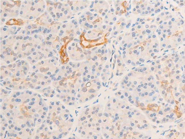 Phospho-GSK3B (Ser9) Antibody in Immunohistochemistry (Paraffin) (IHC (P))