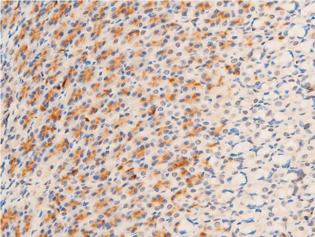 Phospho-GSK3B (Ser9) Antibody in Immunohistochemistry (Paraffin) (IHC (P))