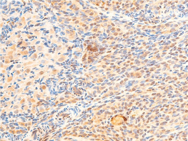 Phospho-GSK3B (Ser9) Antibody in Immunohistochemistry (Paraffin) (IHC (P))