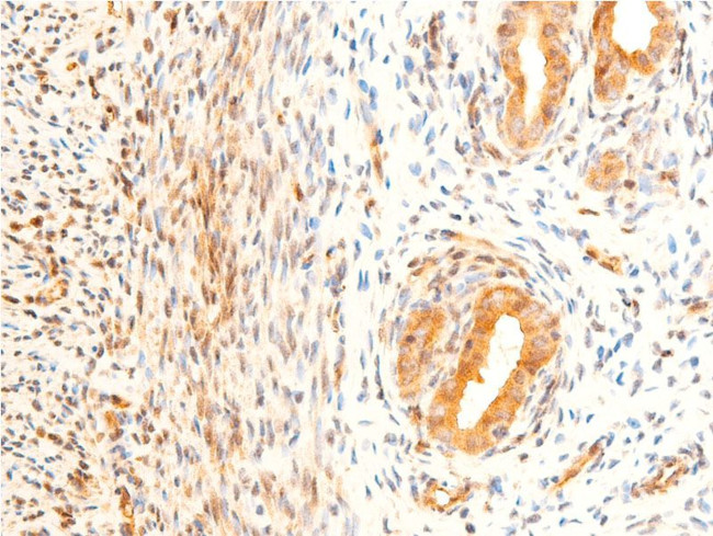 Phospho-GSK3B (Ser9) Antibody in Immunohistochemistry (Paraffin) (IHC (P))