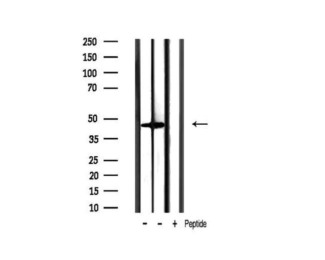 Phospho-GSK3B (Ser9) Antibody in Western Blot (WB)