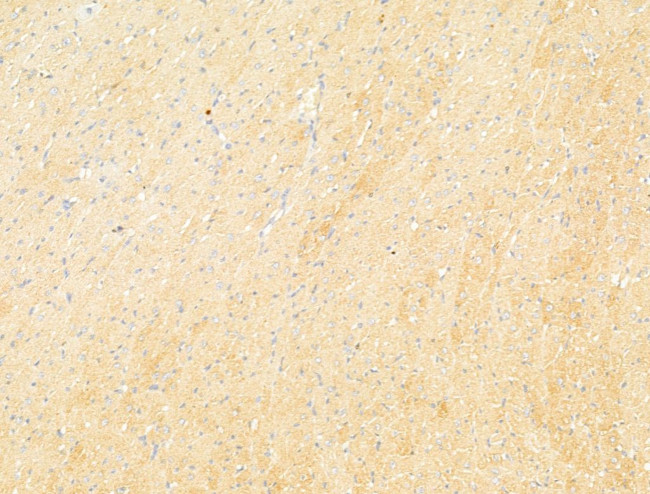 Phospho-ULK1 (Ser317) Antibody in Immunohistochemistry (Paraffin) (IHC (P))